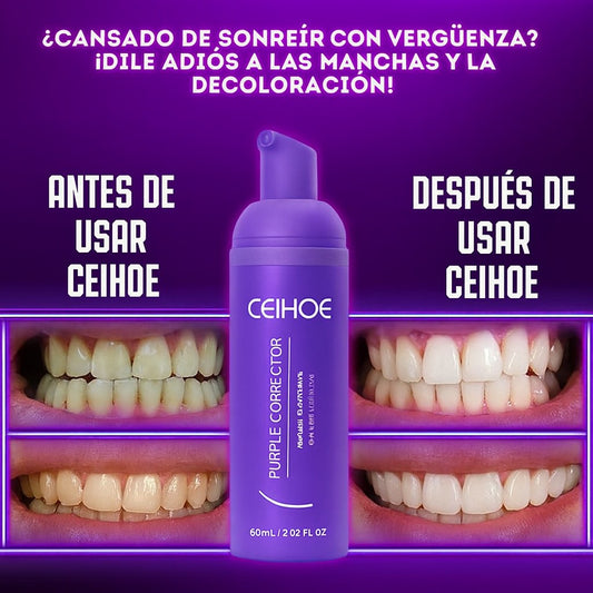 2X1 SUERO MOUSSE CORRECTOR PARA EL BLANQUIAMIENTO DE DIENTES CEIHOE