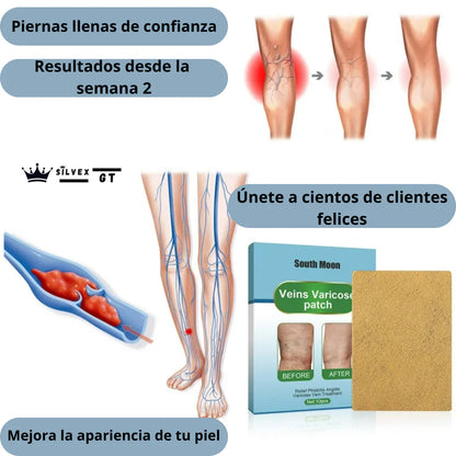 2X1 PARCHES PARA LA HINCHAZÓN DE PIERNAS Y VÁRICES. (CAJA DE 10 UNIDADES)