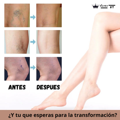 2X1 PARCHES PARA LA HINCHAZÓN DE PIERNAS Y VÁRICES. (CAJA DE 10 UNIDADES)