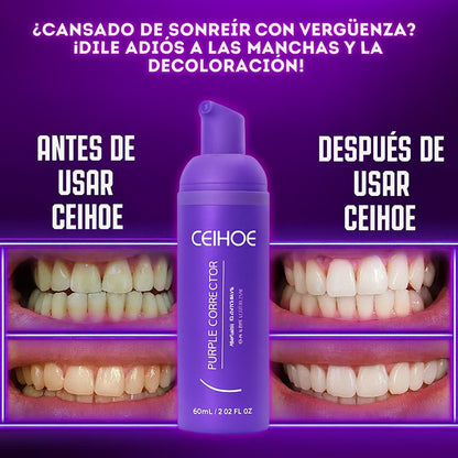 2X1 SUERO MOUSSE CORRECTOR PARA EL BLANQUIAMIENTO DE DIENTES CEIHOE